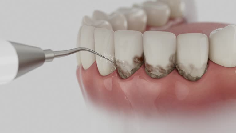 Reliable Invisalign Clear Aligners contractor in Montgomery County County, GA by Dentist Open Now